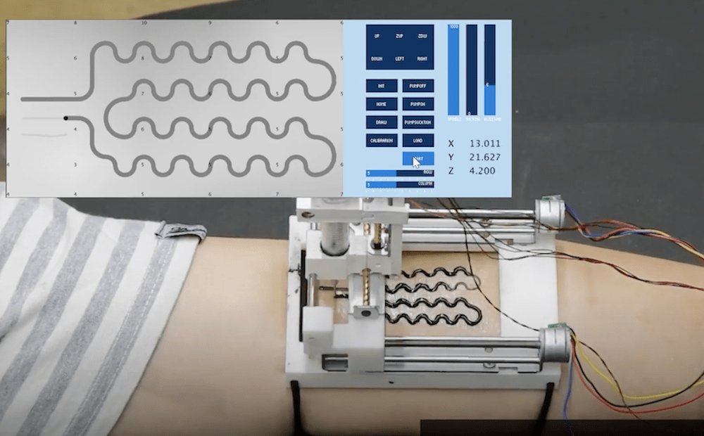 Fabricate flexible electronics directly on your skin with the BodyPrinter