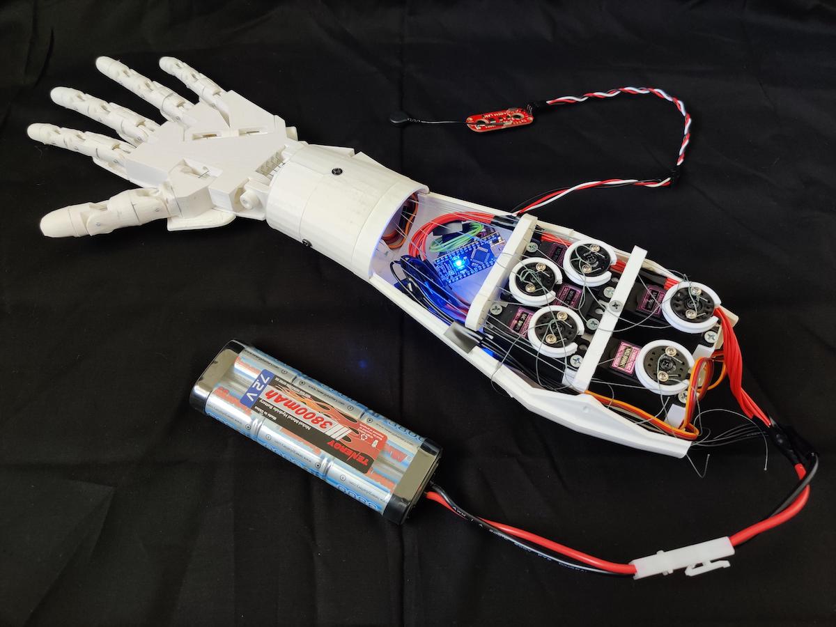 Designing a 3Dprinted EMG bionic hand as a lowcost alternative to